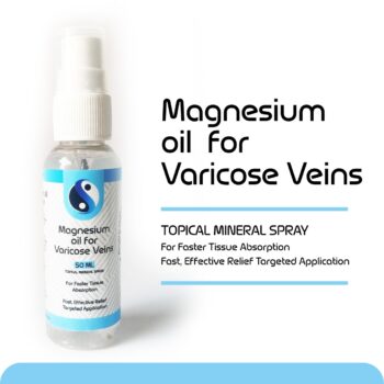 magnesium oil for varicose veins